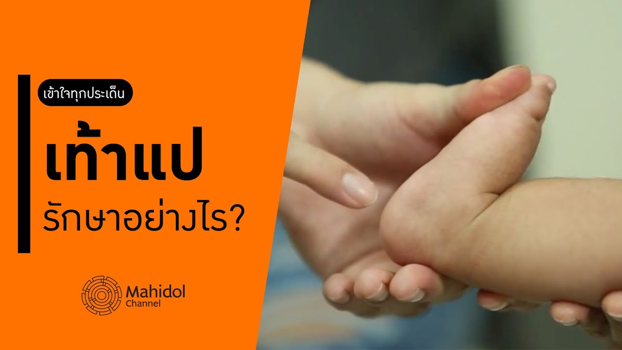 "เท้าแป" ในเด็ก รักษาอย่างไร? [หาหมอ by Mahidol Channel]