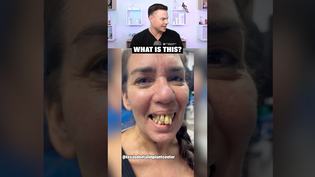 This Smile Transformation Was CRAZY! 😳🦷