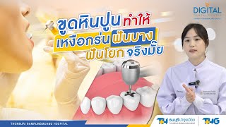 ขูดหินปูนทำให้เหงือกร่น ฟันบาง คอฟันสึก ฟันโยก จริงมั้ย | Digital Dental Center