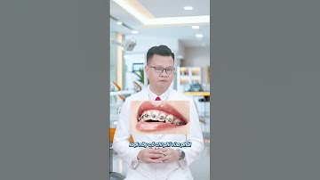 Loại Niềng Răng Nào Phù Hợp Với Học Sinh - Sinh Viên? Những Lựa Chọn Tốt Nhất!