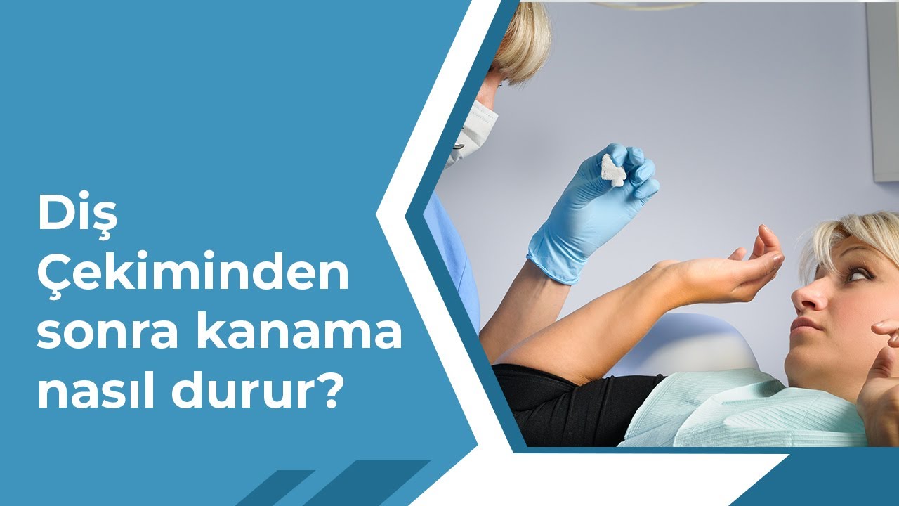 Diş Çekiminden Sonra Kanama Nasıl Durur?