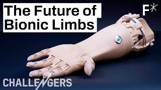 3D printed, mindcontrolled prosthetics are here | Challengers by Freethink