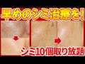 【シミは消えるのか】シミ取りレーザーを治療する前に見て欲しい【湘南美容クリニック医師が解説】