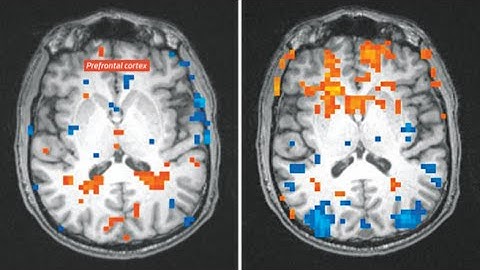 FMRI as lie detector