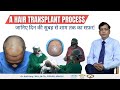 Hair transplant     fullday journey of a hair transplant procedure  by dr anil garg