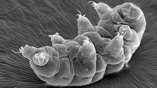 Objects under and Electron Microscope:/ Part 1