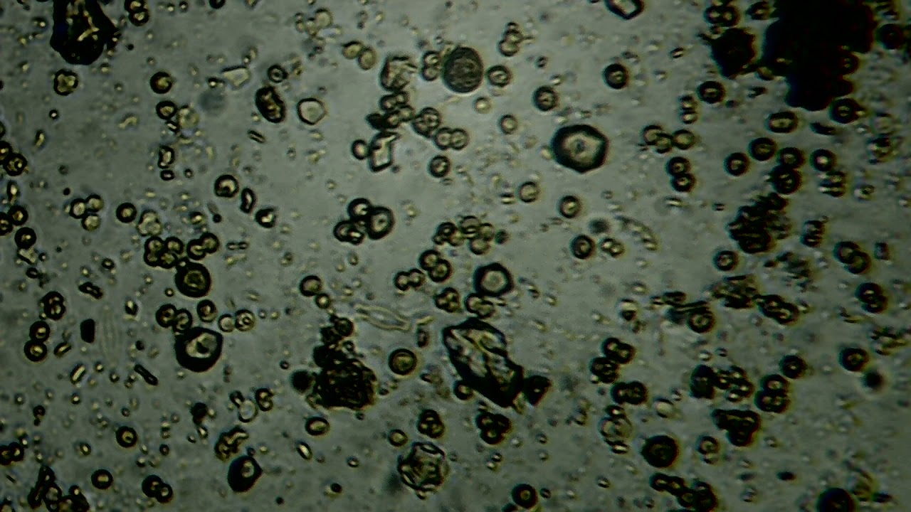 Капля слюны. Микроводоросли микробиология. Вода под микроскопом. Чистая вода под микроскопом. Зрящная вода под микроскопом.