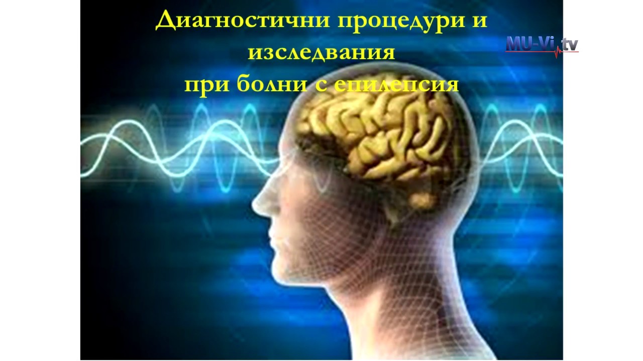 Да поговорим за... – Епилепсия