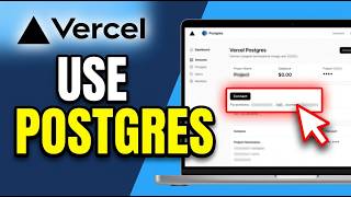 How to Use Vercel Postgres 2026 (Quick & Easy) Net Worth