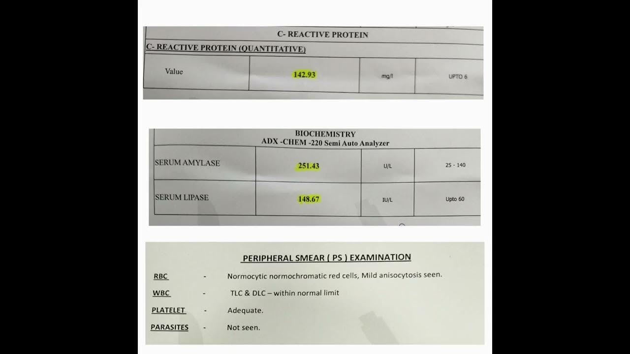 Amylase, lipase, C reactive protein, peripheral smear abnormality