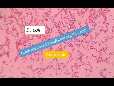 วีดีโอ: E coli rod หรือ cocci มีรูปร่างหรือไม่?