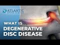 What Is Lumbar Degenerative Disc Disease? | Intervertebral Disc Height Loss