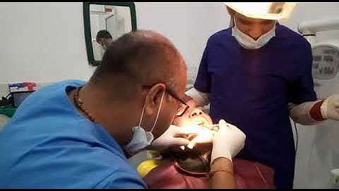 Bio- care implant placement by Dr Amit Oza