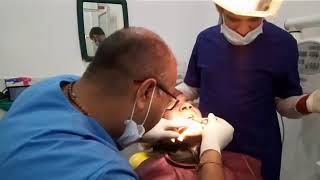 Bio- care implant placement by Dr Amit Oza