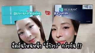 Belotero Revive กับ Rejuran ฉีดอันไหนหน้าฉ่ำวาวกว่ากัน!?