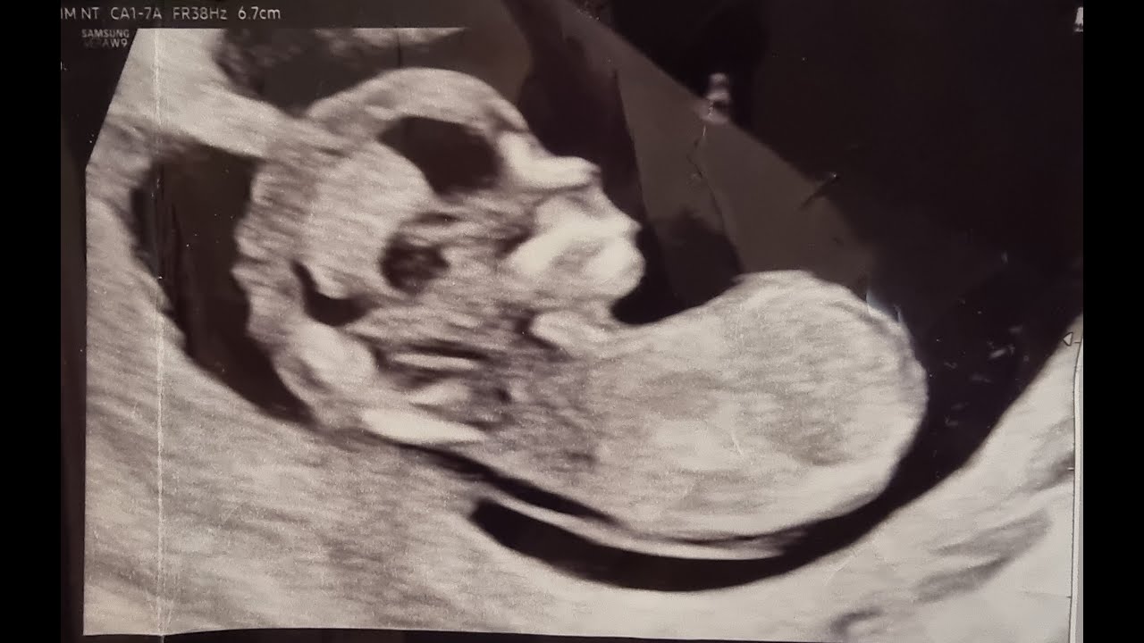 RASKAUSPÄIVÄKIRJA (Rv 4+0 -13+6) lasten reaktio vauva uutiseen🤭🤰🏼