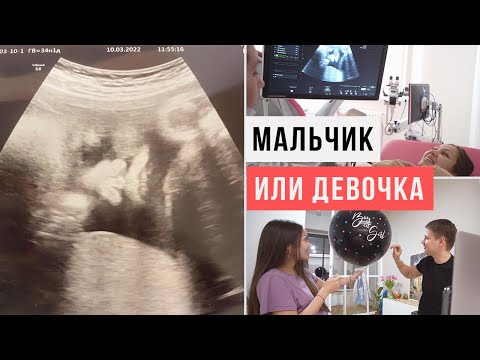 Мальчик или девочка  Естественные роды  ЧАСТЬ 1 / АСКЕЗА В КЕДАХ