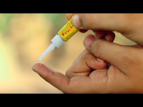 FeviKwik Experiment - फेवीक्विक को  त्वचा से कैसे हटाएं