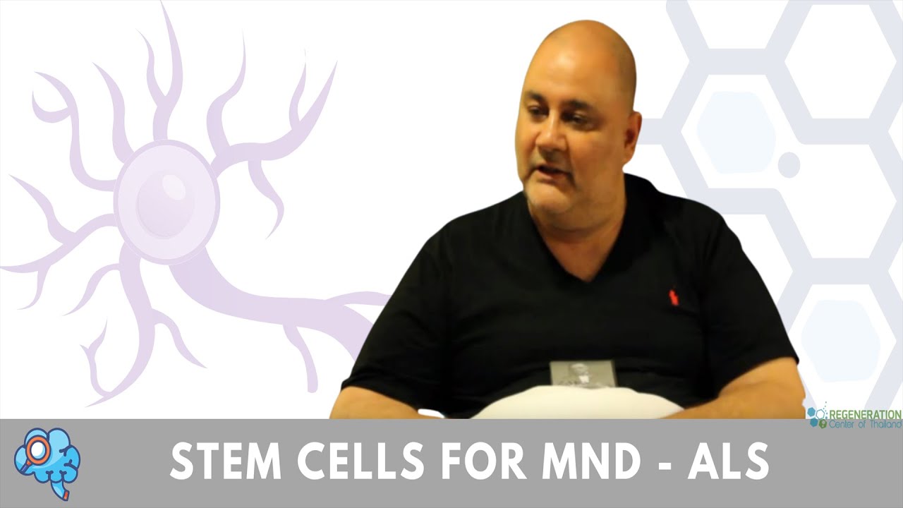 Neural Stem Cell Treatment for Motor Neuron Disease MND & ALS in 2021