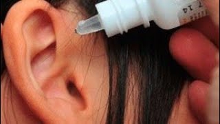 Najbolji Način Za Čišćenje Ušiju I Rešavanje Čestih Upala