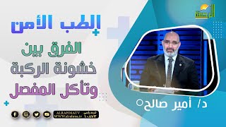 ما الفرق بين خشونة الركبة وتأكل المفصل ؟ || د: أمير صالح