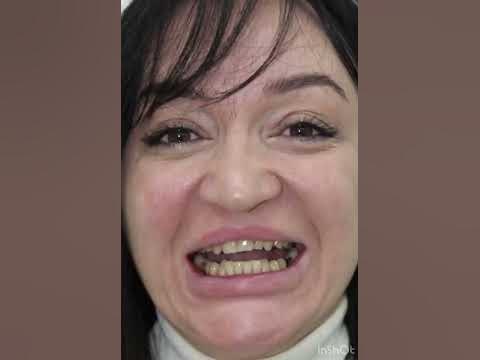 Создание красивой улыбки - YouTube