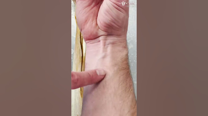 Are You Missing a Forearm Muscle? How to Test For It…