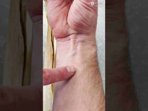 Wideo: Czy potrafisz naciągnąć mięsień ramienny?