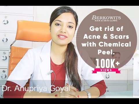 Chemical Peel for Acne Scar and Microneedling Skin Peeling Treatment