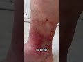 “Как Узнать о Проблемах с Сердцем: 5 Основных Признаков”