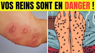 8 Signes Étranges Qui Indiquent Une Maladie Des Reins – NE LES IGNOREZ PAS !