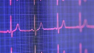 Can Sudden Cardiac Arrest Be Prevented?