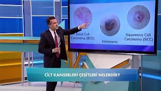 Cilt kanseri çeşitleri nelerdir? Balçiçek İle Dr. Cankurtaran 86. Bölüm