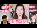 暗瘡不復發! A酸療程+多年護膚心得+推介好物| cheerS beauty【中字】