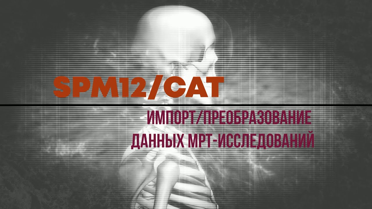 002. SPM12/CAT. Импорт DICOM-файлов. Преобразование в NIfTI-формат.