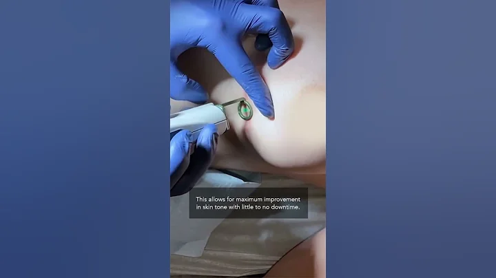 How to reduce Breast Augmentation Scars by Dr. Khorasani | Quadruple Board Certified Derm | NYC