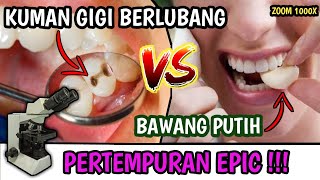 ZOOM 1000X : KUMAN GIGI BERLUBANG VS BAWANG PUTIH CAVITY VS GARLIC UNDER MICROSCOPE ~ MUJARAB ???