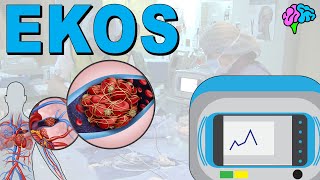 EKOS Endovascular System EXPLAINED!