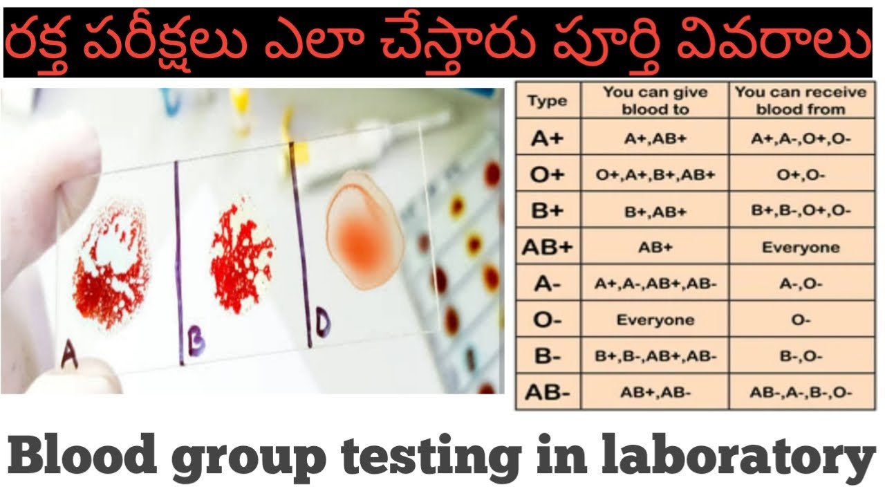Blood group testing in laboratory bloodgroup health YouTube