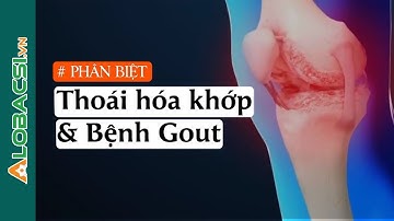 Phân Biệt Gout, Viêm Khớp, Thoái Hóa Khớp!| BS.CK2 Đoàn Thị Huyền Trân