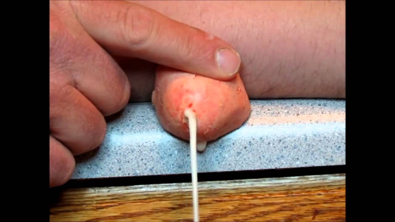 The most ridiculous zit ever - YouTube The most ridiculous zit ever - YouTube