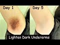 Lighten Dark Underarms in 5 Days - Dark Underarms Whitening Turmeric Pack & Potato Pack