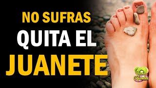 Remedio Para Juanetes De Los Pies by DIANA CIFUENTES 552 views 1 year ago 3 minutes, 18 seconds