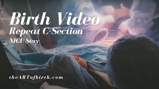 NICU Stay after birth | C-Section birth video