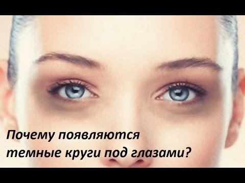 Все обо всем - Почему появляются темные круги под глазами?