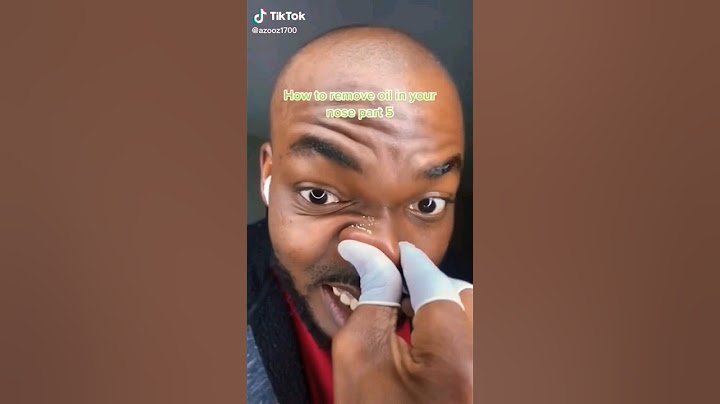 OMG 😧 It worked😜| Remove your nose oil NOW! #shorts #trending #viral #youtuber #satsfyingvideo