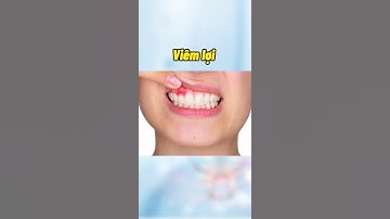 #9 Răng bị lung lay khi niềng là điều bình thường hay bất thường| NHA KHOA LÊ ĐÔNG #shorts