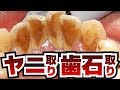 [膿がスゴい]ヤニ取り～歯石取り[Tartar removal][喫煙者]歯石Vol.6(去除煙垢去除牙石)