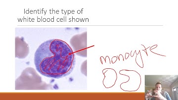 AP II Practice Lab Exam 1: Blood & Heart