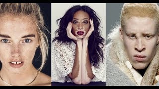 10 Most Unique Models Revolutionizing The Fashion World